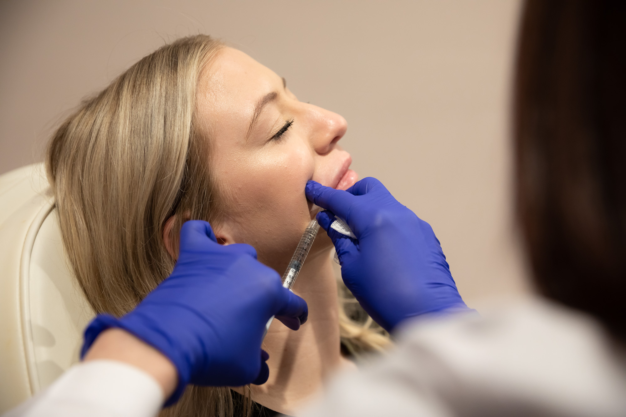 A young blonde patient at Exhibit Medical Aesthetic receiving injections of filler near Madison, NJ. to address wrinkles caused by skin laxity and volume loss.