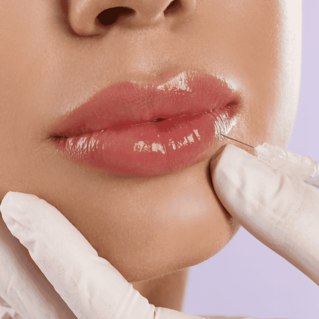 close up on woman getting lip filler injected into her bottom lip