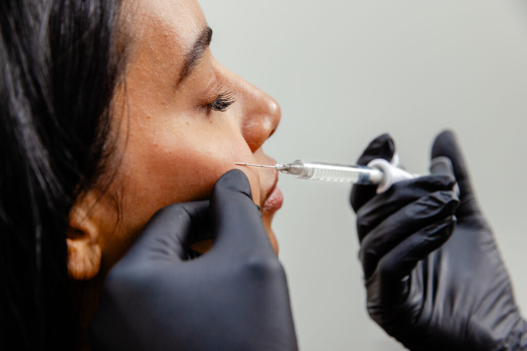 Up-close angle of patient receiving Botox in cheek