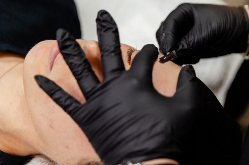 Nurse dermaplanes patient's forehead