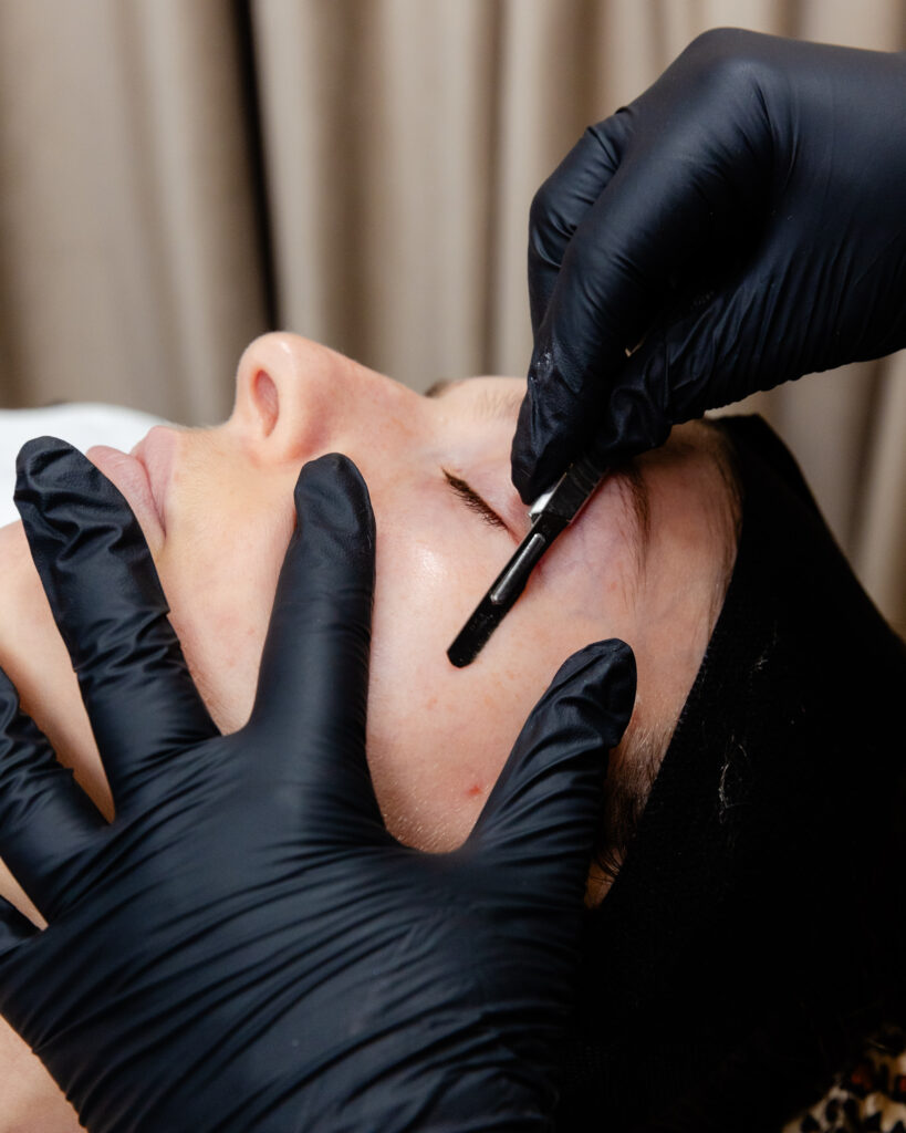 Nurse wearing gloves dermaplanes patient