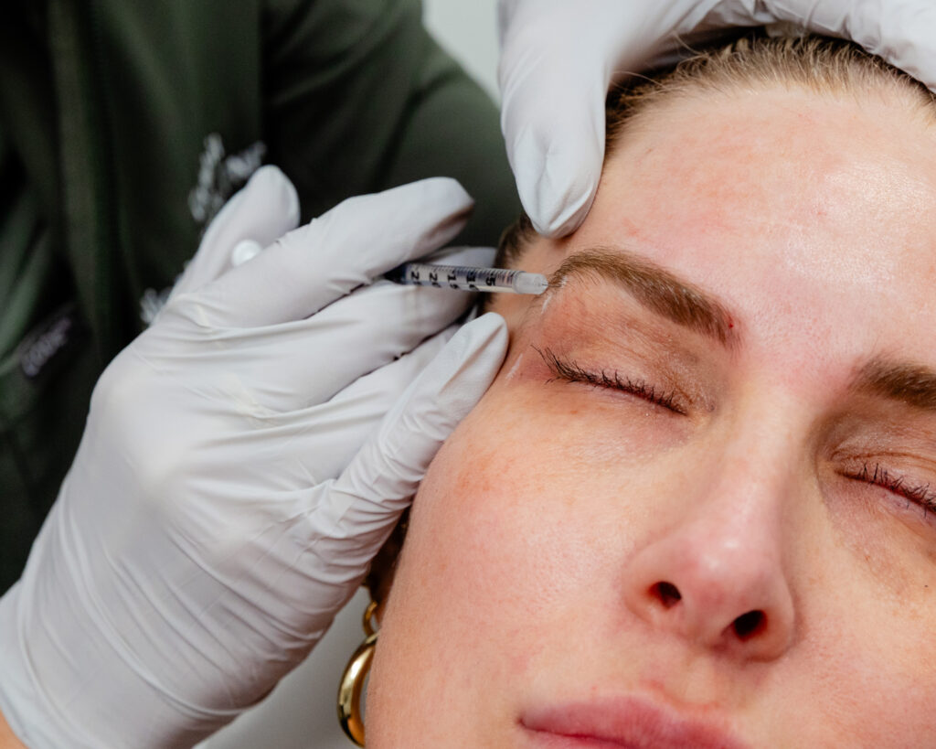 Needle inserted underneath woman's eyebrow