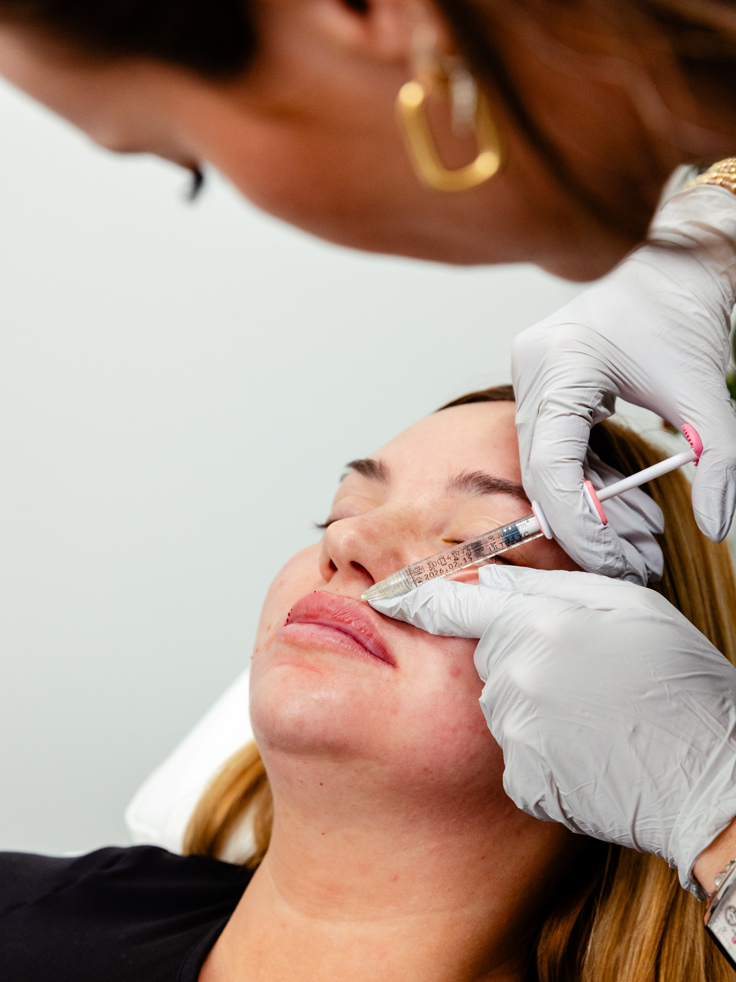 Nurse gives patient lip fillers
