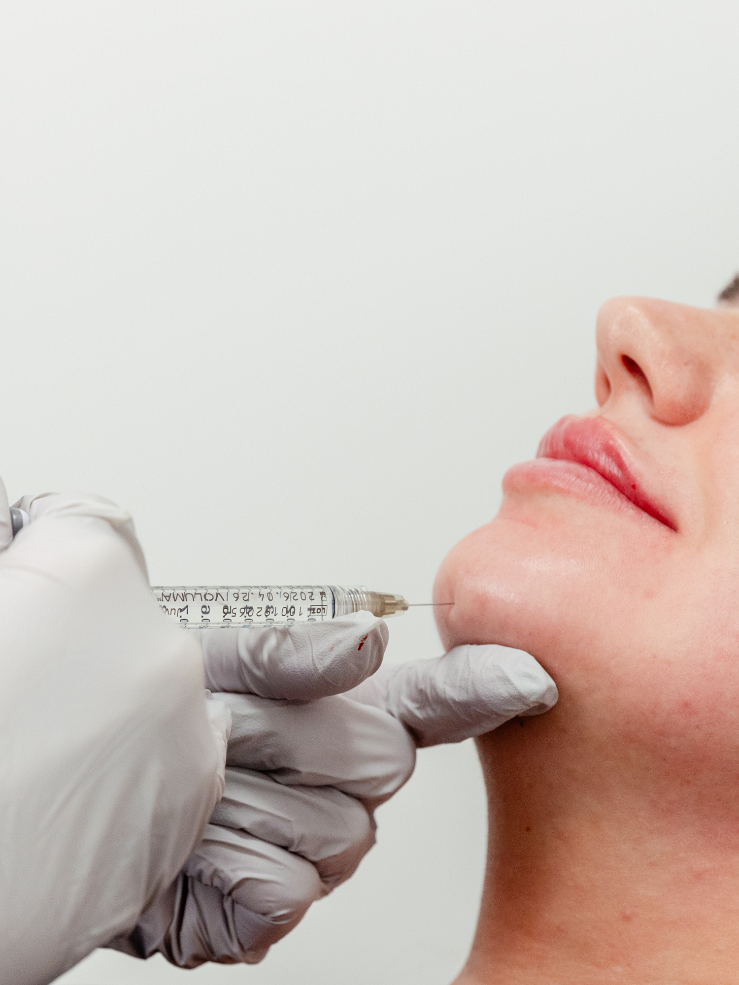 Patient receives filler on chin
