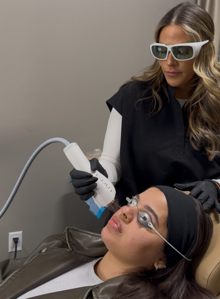 Nurse Practitioner giving customer Moxi BBL Laser on upper cheek