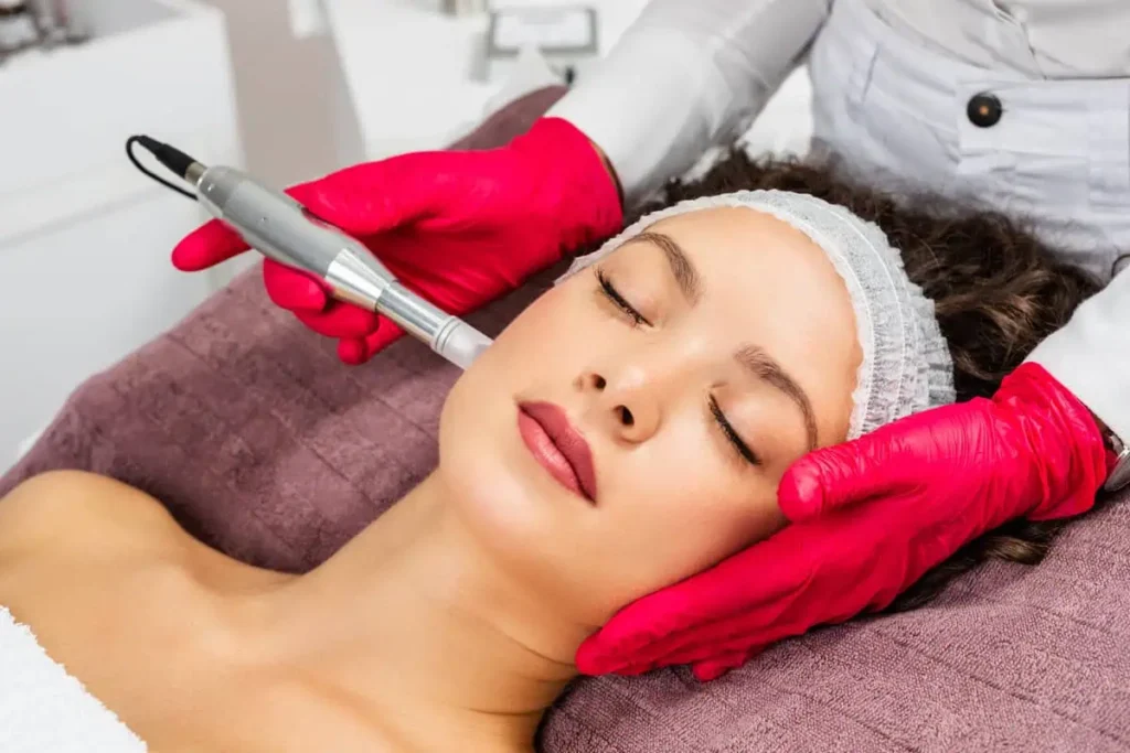 Woman laying down receiving microneedling procedure