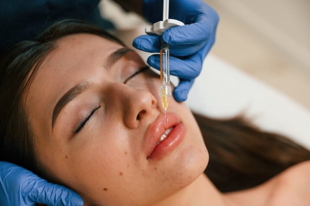 Woman lying down with needle inserted into her top lip.