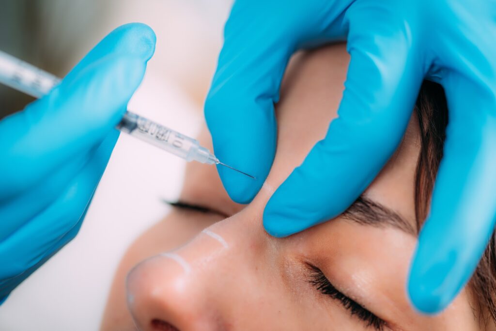Up close photo of nurse injecting needle between eyebrows.