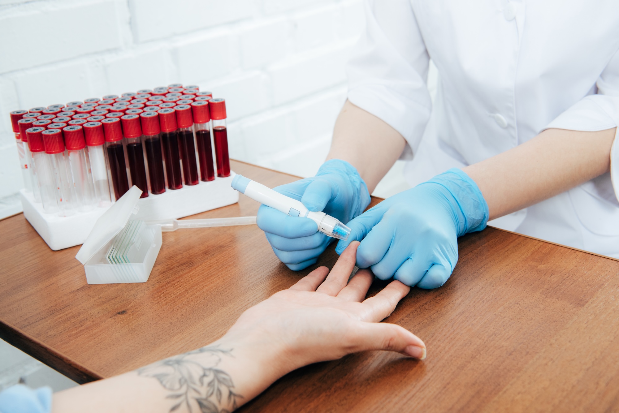 cropped view of donor and doctor obtaining blood sample