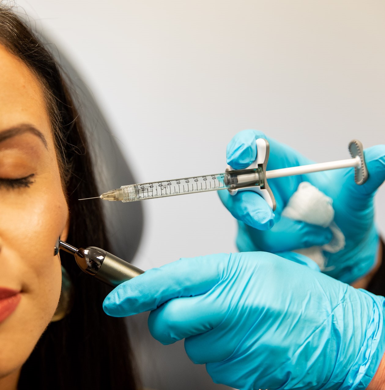 woman receiving cheek filler on midface